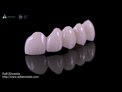 High Translucency Full Contour Zirconia Bridge Chipping Resistance Natural Esthetics