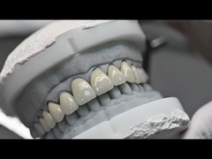 Translucency CAD EMAX Veneer Polished Glazed Ceramic Restorations For Anterior Posterior Areas
