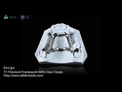 High Strength 3D Printed Titanium Framework With Clear Clasps For Durable Performance
