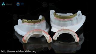 China Dental Lab Precision Restorations