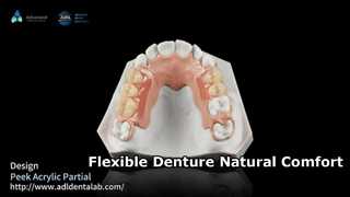 Partial Denture Comfort & Strength