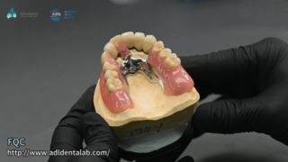 Telescope Crown Precision Soldering Quality