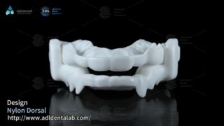 Stop Teeth Grinding With Custom Nylon Dorsal Night Guards
