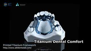 Lightweight Titanium Dental Framework for Sensitive Skin