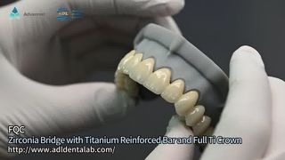 Advanced Dental Lab Zirconia Restorations