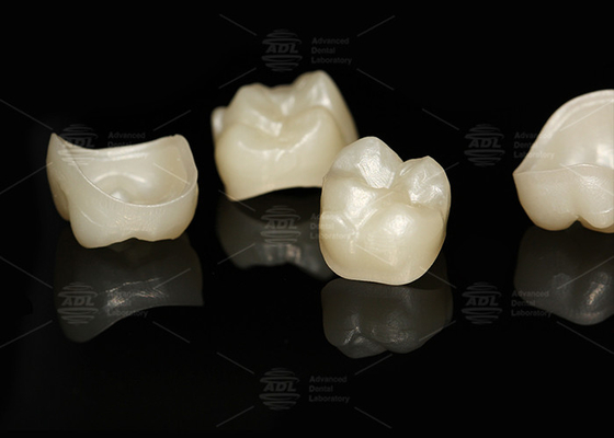 Buy Natural Full Contour Zirconia Crown Precise Fit Full Contour Dental Lab online manufacture