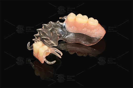 Buy Vertex Clear  Flexible Partial Virtually Unbreakable Low Allergy Risk Full Partial Denture online manufacture