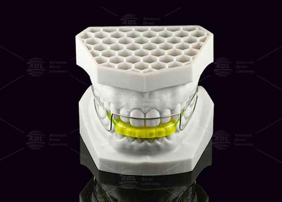 Buy Acrylic Orthodontic Bionator Appliance Corrects Class II Malocclusion online manufacture