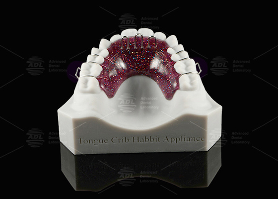 Buy Habbit Orthodontic Tongue Crib Appliance Customizable Dental Crib Appliance online manufacture