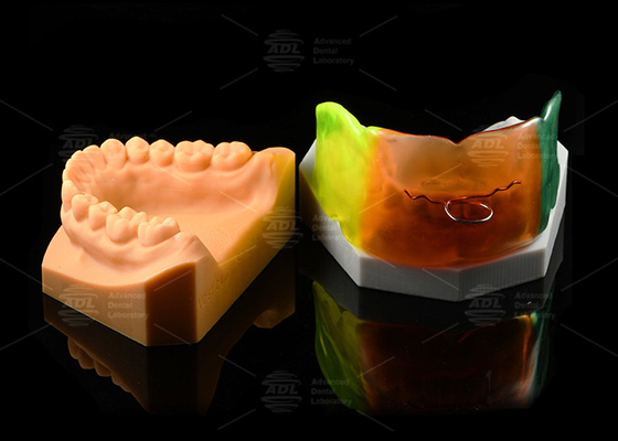 Buy Adjustable Medical Silicone Vestibular Shield Breathable Orthodontic Functional Appliance online manufacture