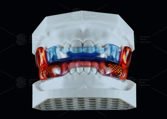 buy Medical Grade Silicone Anti Snoring Appliance RP For Improved Sleep online manufacture