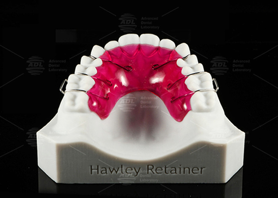 Buy Comfortable Stainless Steel Acrylic Hawley Retainer Effective Orthodontic Solution online manufacture