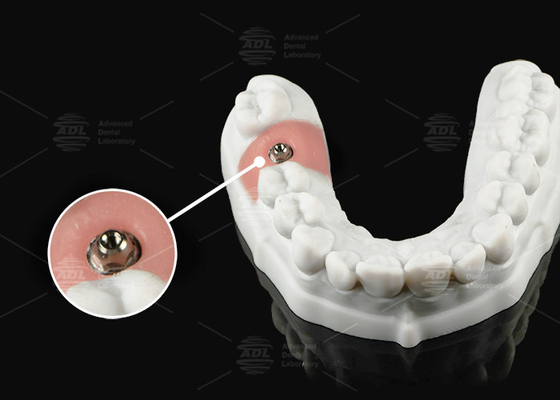 Buy Silver Gold Titanium Multi Unit Abutment For Single Or Multi Unit Prosthetic Platform online manufacture