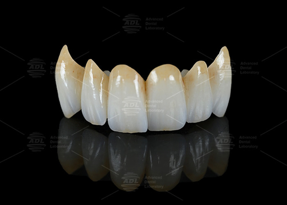 Buy High Translucency Full Contour Zirconia Bridge Chipping Resistance Natural Esthetics online manufacture