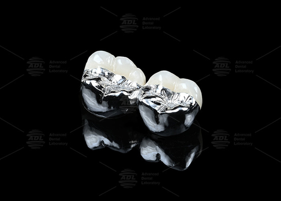 Buy Co Cr Ceramic PFM Restorations Cad Cam Pfm Crown Natural Looking online manufacture
