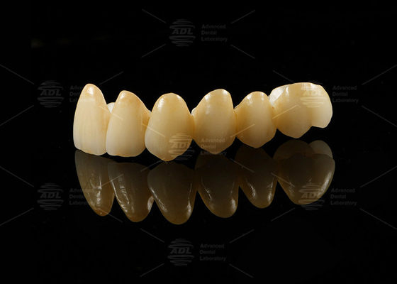 Buy Strong Aesthetic Porcelain Fused To Zirconia For Natural Looking Restorations online manufacture