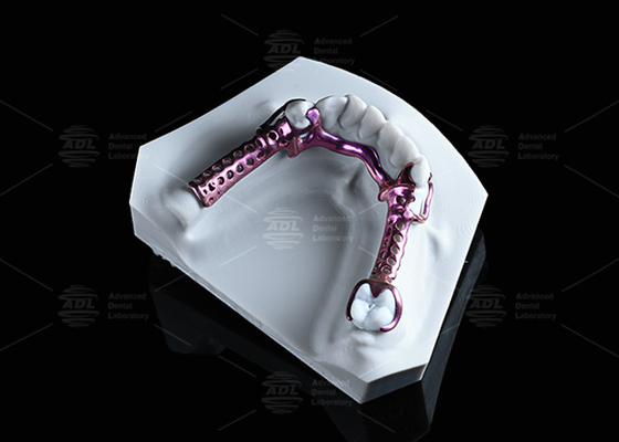 Buy Anodized 3D Titanium Framework High Strength And Lightweight And Adjustable online manufacture