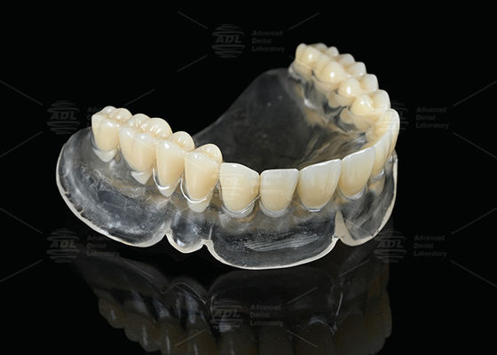 buy Heat Curing Vertex Thermosens Dentures For Clear Full Denture Wearers online manufacture