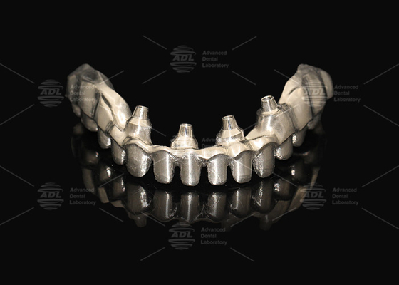 Buy Hybrid Pink Porcelain Implant Crown Malong Full Arch Implant Bridge Immediate Loading online manufacture