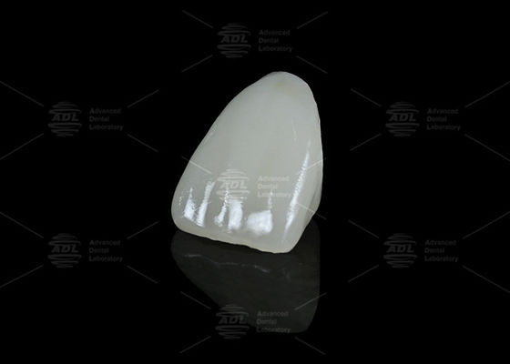 Buy China Dental Lab Hybrid Ceramic Vita Enamic Dental with Translucency for Single Tooth Restorations online manufacture