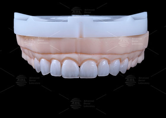 buy China Dental Lab Over 13 Years In Dental Lab Industry Providing Emax Veneer 16 Shades To Meet Diverse Dental Restoration Needs online manufacture