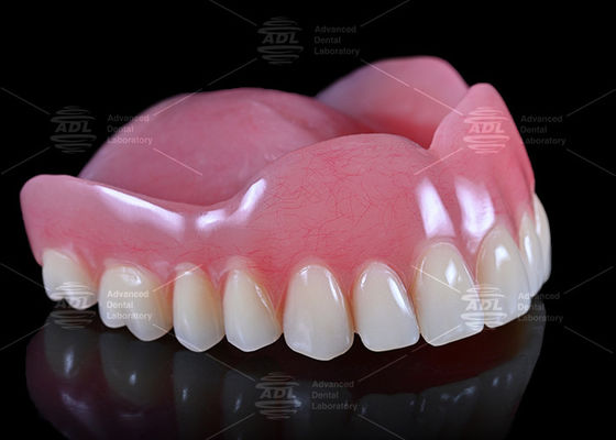 buy China Dental Lab High Esthetics Customized Full Acrylic Denture Full Service for Worldwide online manufacture