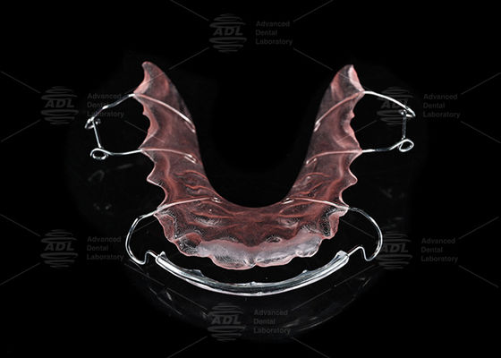 Buy China Dental Lab Stainless Steel And Acrylic Orthodontic Hawley Retainer For Orthodontic Treatment online manufacture