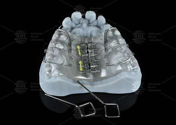 Buy China Dental Lab Colorful Stainless Steel Screw Expander for Maxilla and Mandible Expansion online manufacture