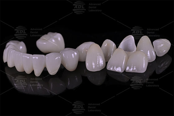 buy China Dental Lab Porcelain Fused To Zirconia High Strength Providing Tailored Services To International Dental Lab And Dentist online manufacture