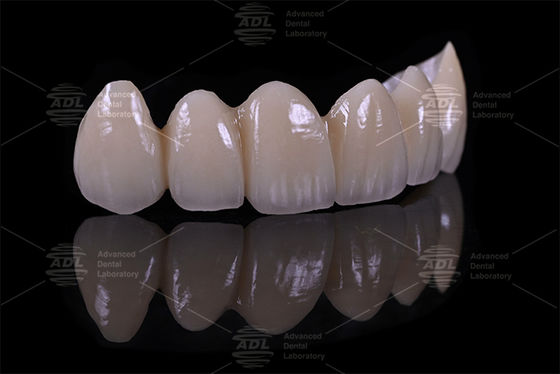 buy Top 5 China dental lab providers Porcelain Fused To Zirconia ensuring turnaround time in 72 hours service for dental offices and labs online manufacture