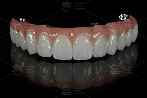 buy China Dental Lab Fast Turnaround Time In 72 Hours Provides High Quality All on X online manufacture