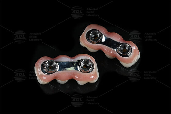 Buy Reinforcement Implant Bar CAD CAM Designed For Precision Fit Compatible With Most Dental Implant Systems Ensuring Dental Restoration Solutions Chinese Dental Lab online manufacture