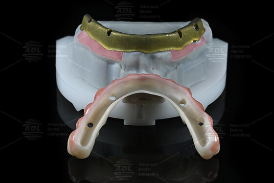 buy China Dental Lab Compatible With Most Dental Implant Systems All on 4 Offering In 72 Hours Turnaround Time And Array Technical Parameters online manufacture