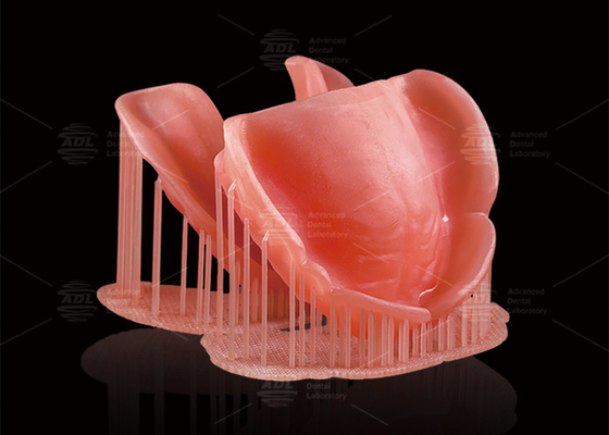 CAD/CAM Digital Removable Partial Dentures Deep Pink Computer Printed Dentures