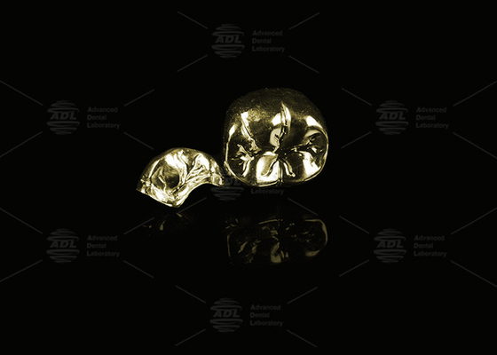 Precious Alloy Yellow Gold 60% Full Metal Crown Gold Finish Complete Metal Crown