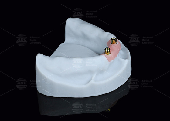 Titanium Locator Dental Attachments For Overdentures In Silver And Gold Finish