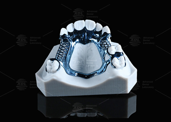 Anodized 3D Printed Titanium Framework Lightweight And Suitable For Sensitive Skin