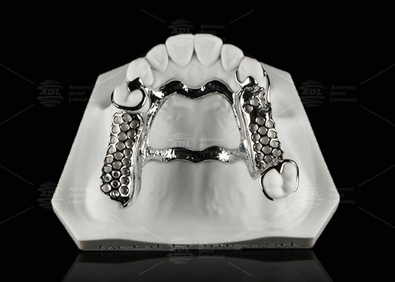 Repairable Cobalt Chromium Dental Metal Framework Partial Denture