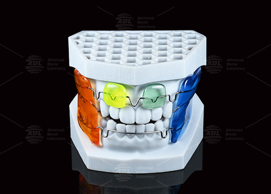 Frankel Ⅲ Malocclusion Orthodontic Functional Appliance 13-16 Hours During Night
