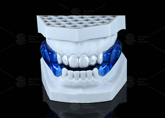 Comfortable Moses Anti Snoring Guard Soft Stop Snoring Mouthpiece