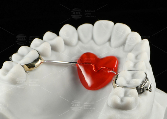 Stainless Steel Orthodontic Nance Appliance Horseshoe Design Orthodontic Appliances