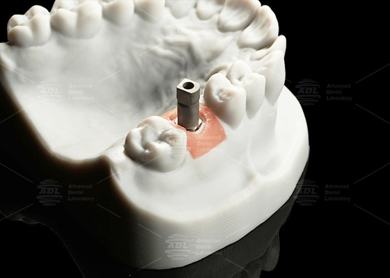 Precision Titanium Digital Implant Scan Body Sandblasted Surface For Cad/Cam