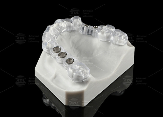 Custom Made Transparent Dental Implant Solution Surgical Stent Ergonomic Design