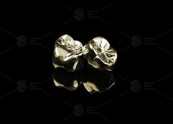 Sleek Full Cast Metal Crown Precious Alloy Gold 20% Polished Full Metal Dental Crown