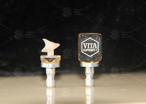 Hybrid Ceramic Vita Enamic Single Tooth Restorations With High Translucency