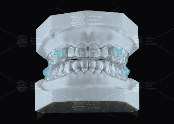 Transparent Erkodent Silensor Anti Snoring Mouthpiece Custom Fit Noise Reduction