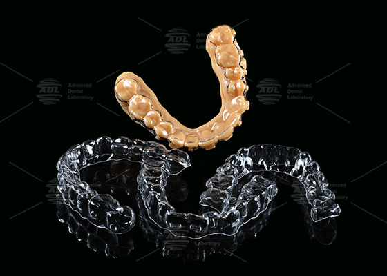 Customizable Invisible Aligner Clear Aligner With Shorter Treatment Time