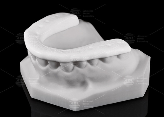 Durability and Breathability 3D Printed Nylon Occlusal Splint / Night Guard for Active Lifestyles