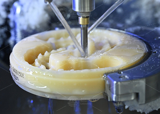 Discover the Power of Milled Full Denture Aesthetically Pleasing and Natural-Looking for Perfect Smiles