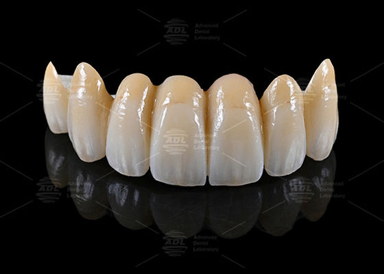 China Dental Lab Providing AIDITE ZIRCONIA BLOCK Materials Alongside Turnaround Time In 72 Hours For Dental Manufacturing
